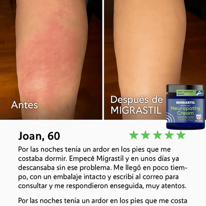 Calma el Ardor y Hormigueo en Minutos – Migrastil Crema Natural para Neuropatía